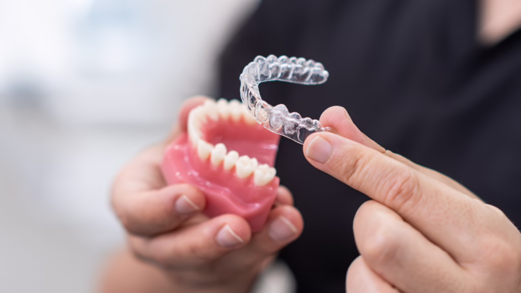 Can Clear Aligners Fix an Overbite?